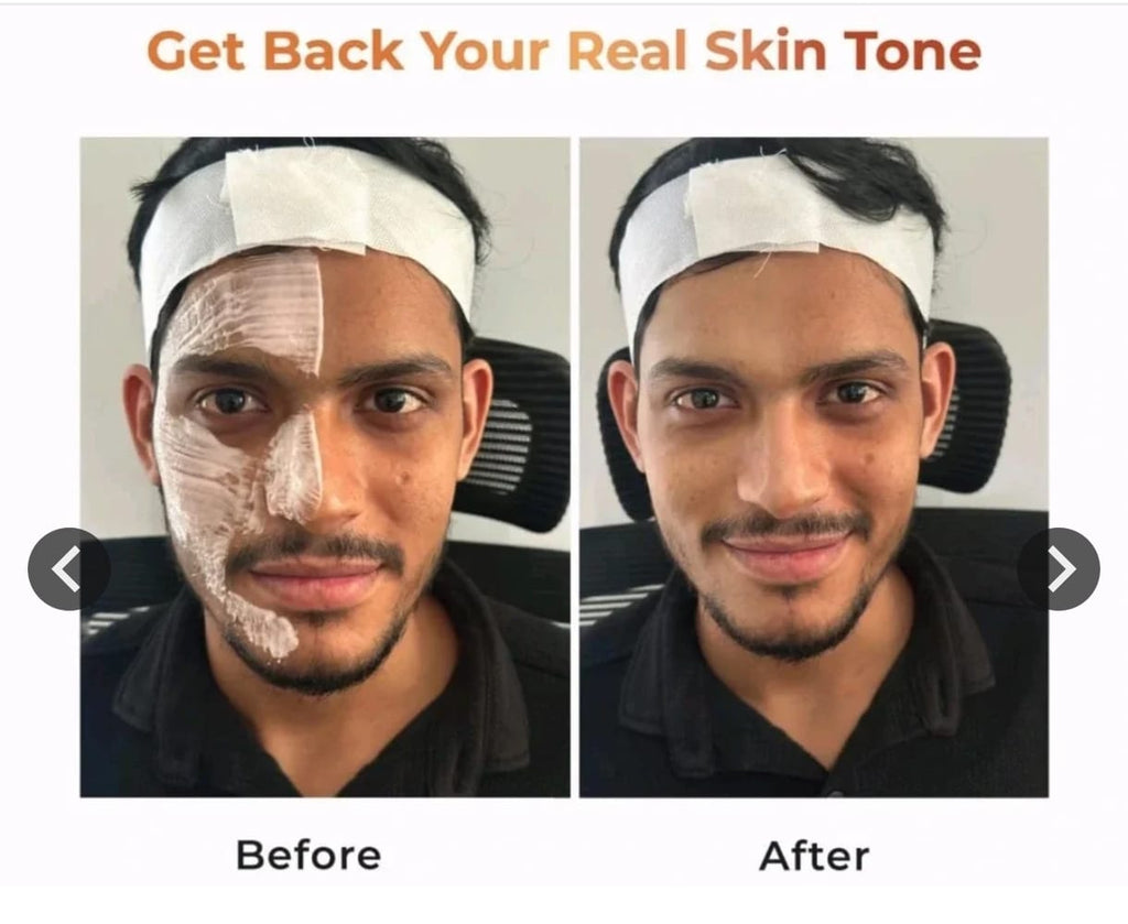Niconi Men Enzyme De-Tan Pack For Face & Body (300g) - Advanced Tan Removal Cream